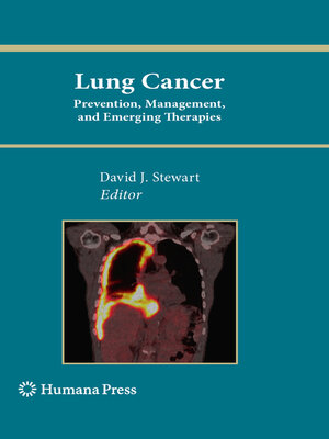 cover image of Lung Cancer